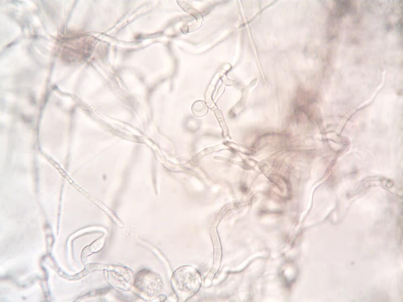 Close-up of a nematode